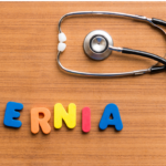 HERNIA: TYPES AND SURGICAL MANAGEMENT